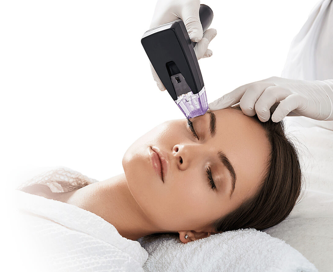 9 Reasons to Use Morpheus8 Under Eyes | EverYoung Skin Care Clinic Vancouver