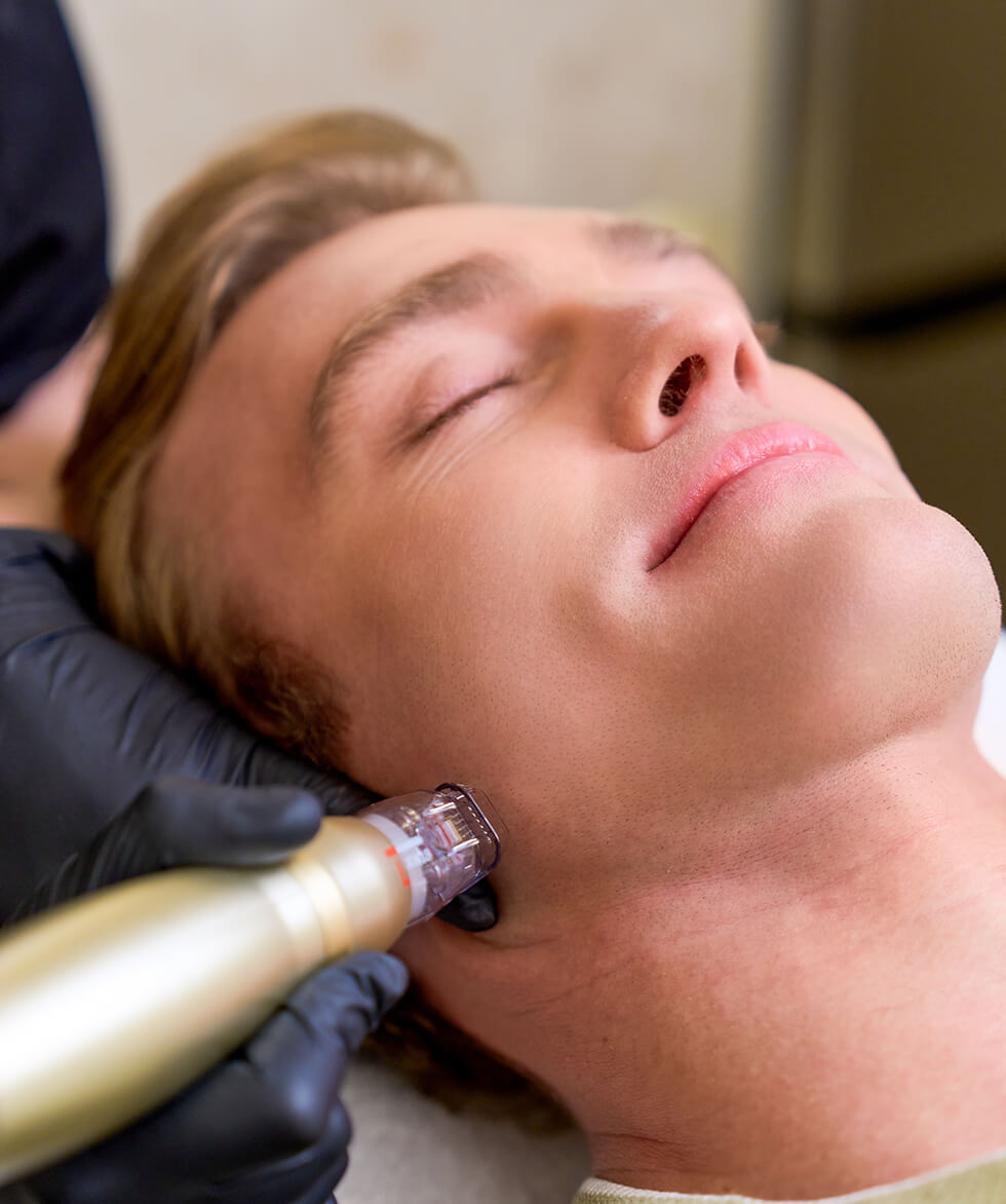 Sofwave Treatment Vancouver | EverYoung Skin Clinic