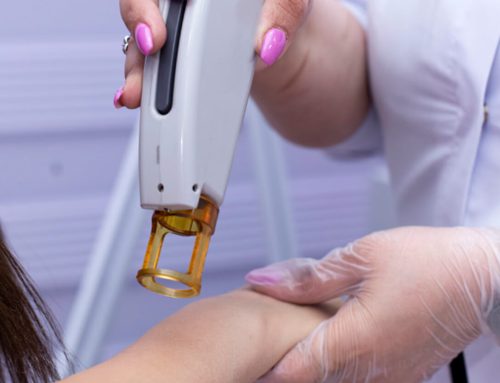 7 Ways You Can Actually Take Care Of Your Skin After Laser Tattoo Removal