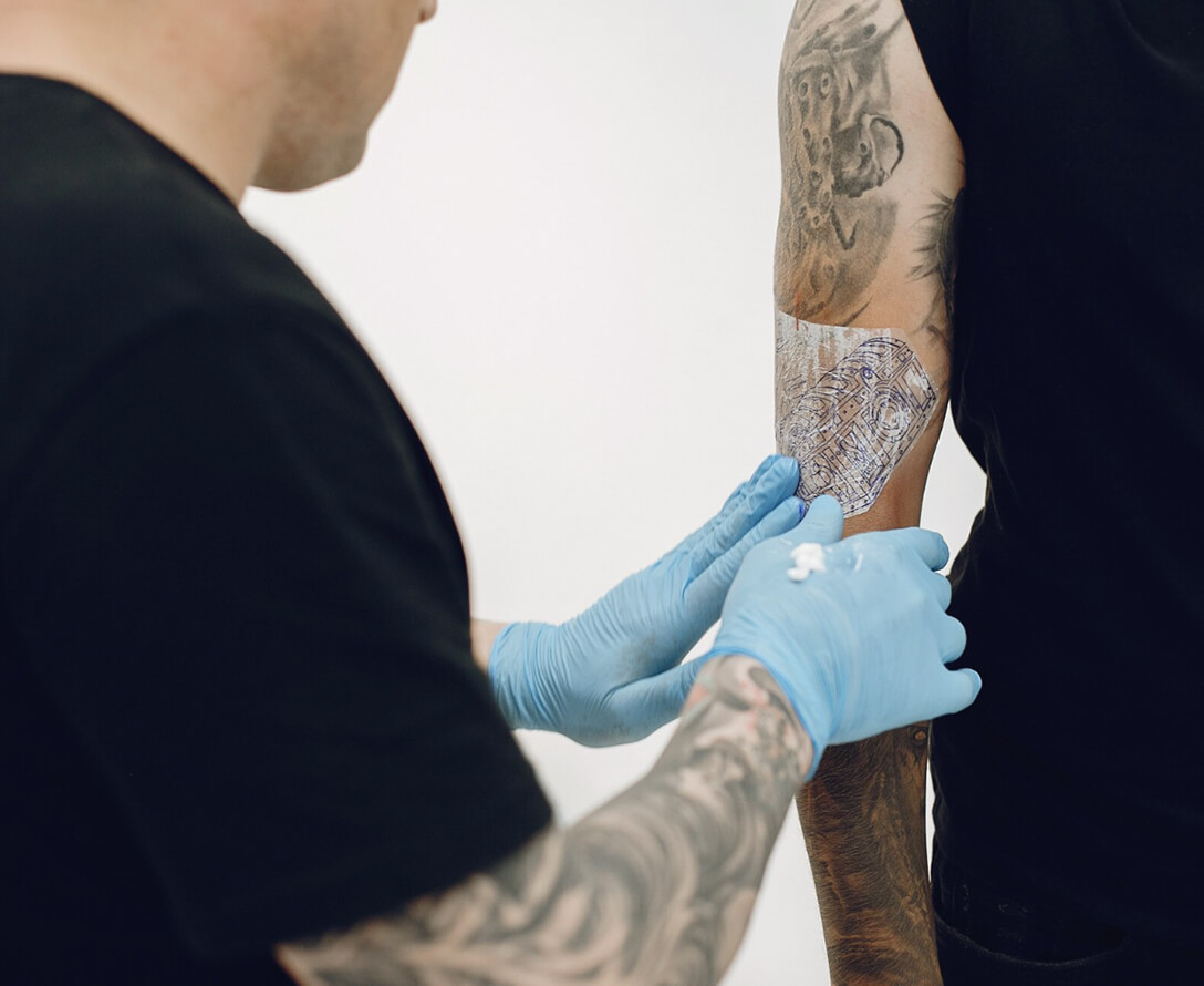 Rethink Your Ink: How To Remove a Tattoo | EverYoung Skin Care Clinic