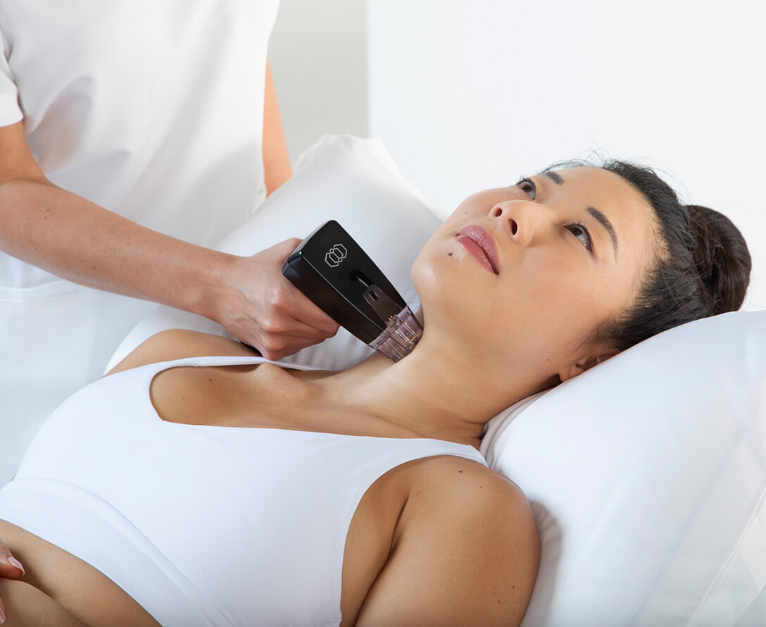 What Areas of Body Can be Treated with Morpheus8? | EverYoung Skin Care Clinic Vancouver