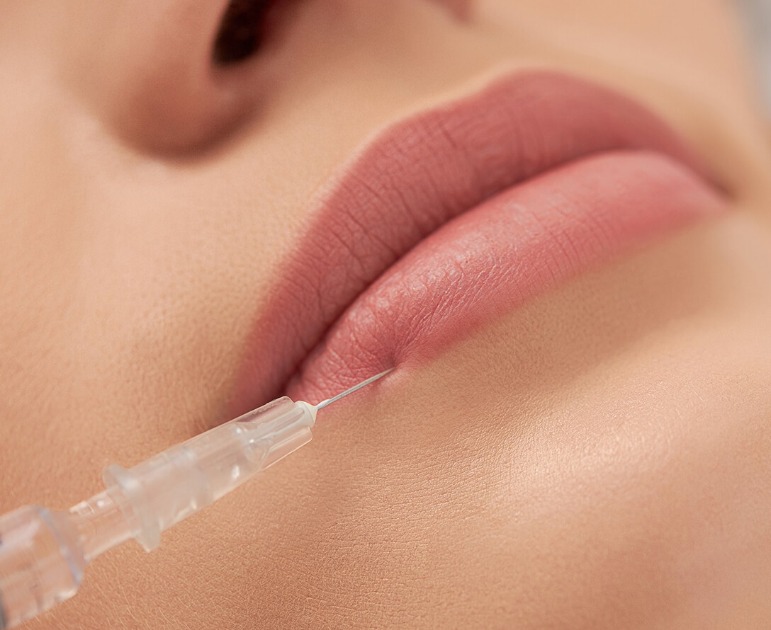Choose Your Lip Volume: Mild, Medium, or Extra Spicy! | EverYoung Skin Care Clinic Vancouver