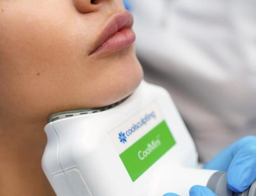 Using CoolSculpting for Double Chin