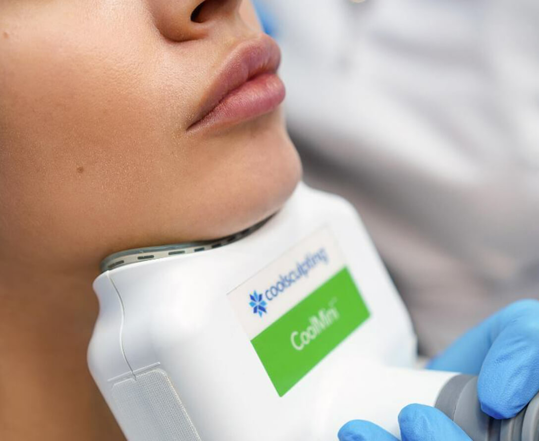 Using CoolSculpting for Double Chin | EverYoung Skin Clinic Vancouver