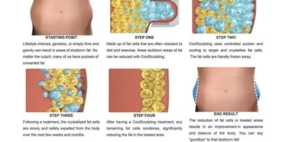 CoolSculpting Process | EverYoung Skin Clinic Vancouver
