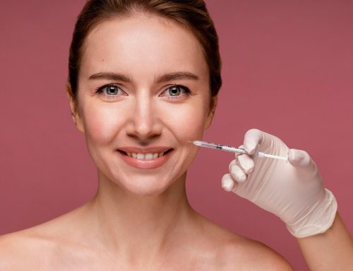 Dermal Fillers for Smile Lines