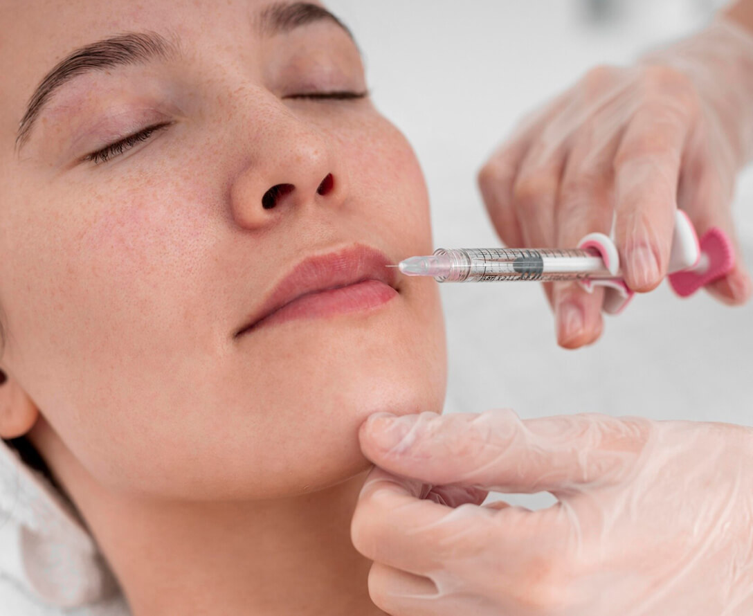 What's the Difference Between Sculptra and Dermal Fillers? | EverYoung Skin Clinic Vancouver