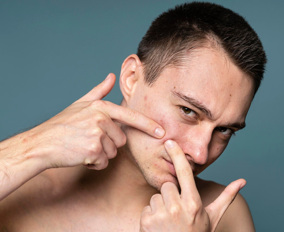 Exploring Blue Light Therapy for Acne | EverYoung Skin Care Clinic Vancouver