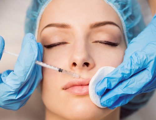 5 Major Lip Filler Benefits