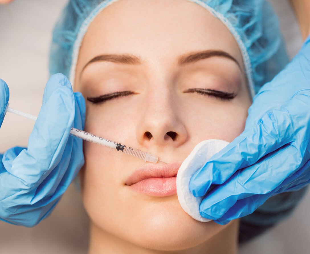 5 Major Lip Filler Benefits | EverYoung Skin Clinic Vancouver