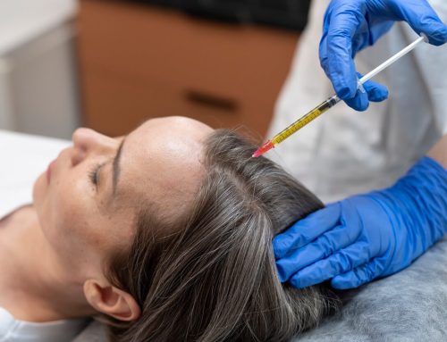 Hair Restoration, All You Need To Know