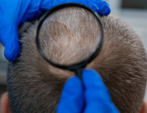 Everything You Need To Know About Platelet-Rich-Plasma For Skin Rejuvenation And Hair Growth