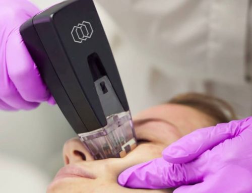 How Long Does Morpheus8 Last?