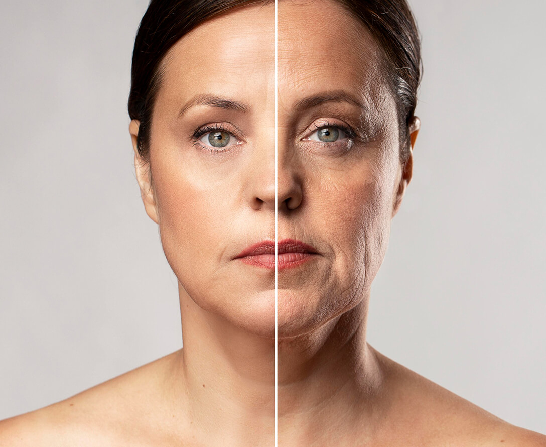 I Got A Liquid Facelift And The Results Are AMAZING! | EverYoung Skin Clinic