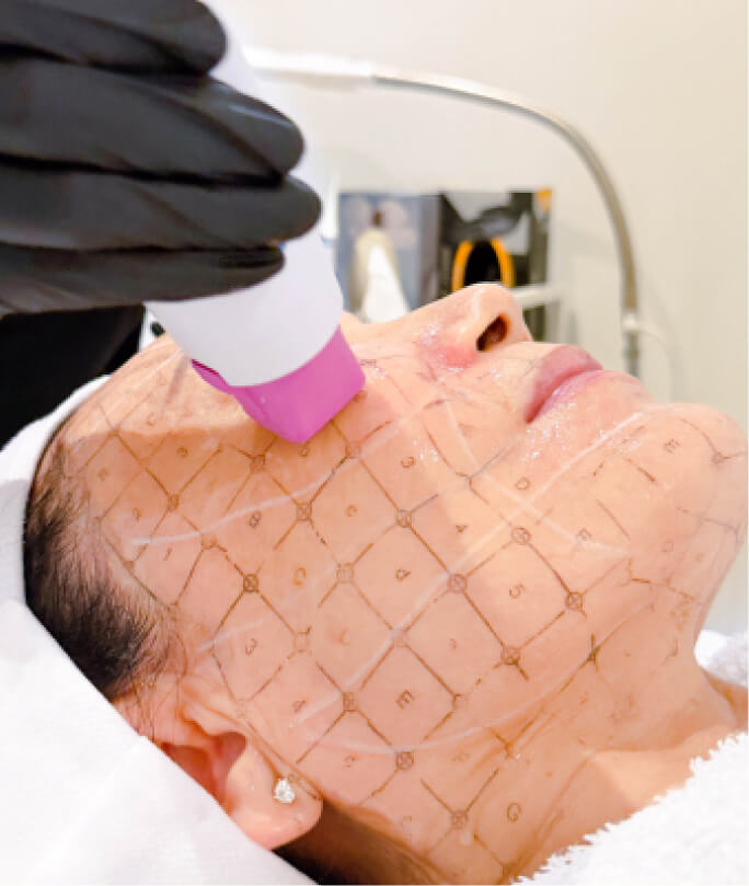 Sylfirm Treatment Vancouver | EverYoung Skincare Clinic