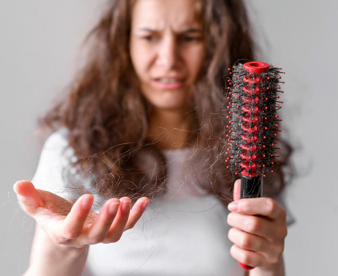 Is Your Hair Loss Giving You The Jitters? 5 Ways You Can Control It Now! | EverYoung Skin Clinic Vancouver