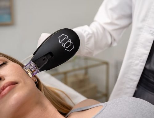 Morpheus8 vs. Microneedling: Which Skin Rejuvenation Technique is Right for You?