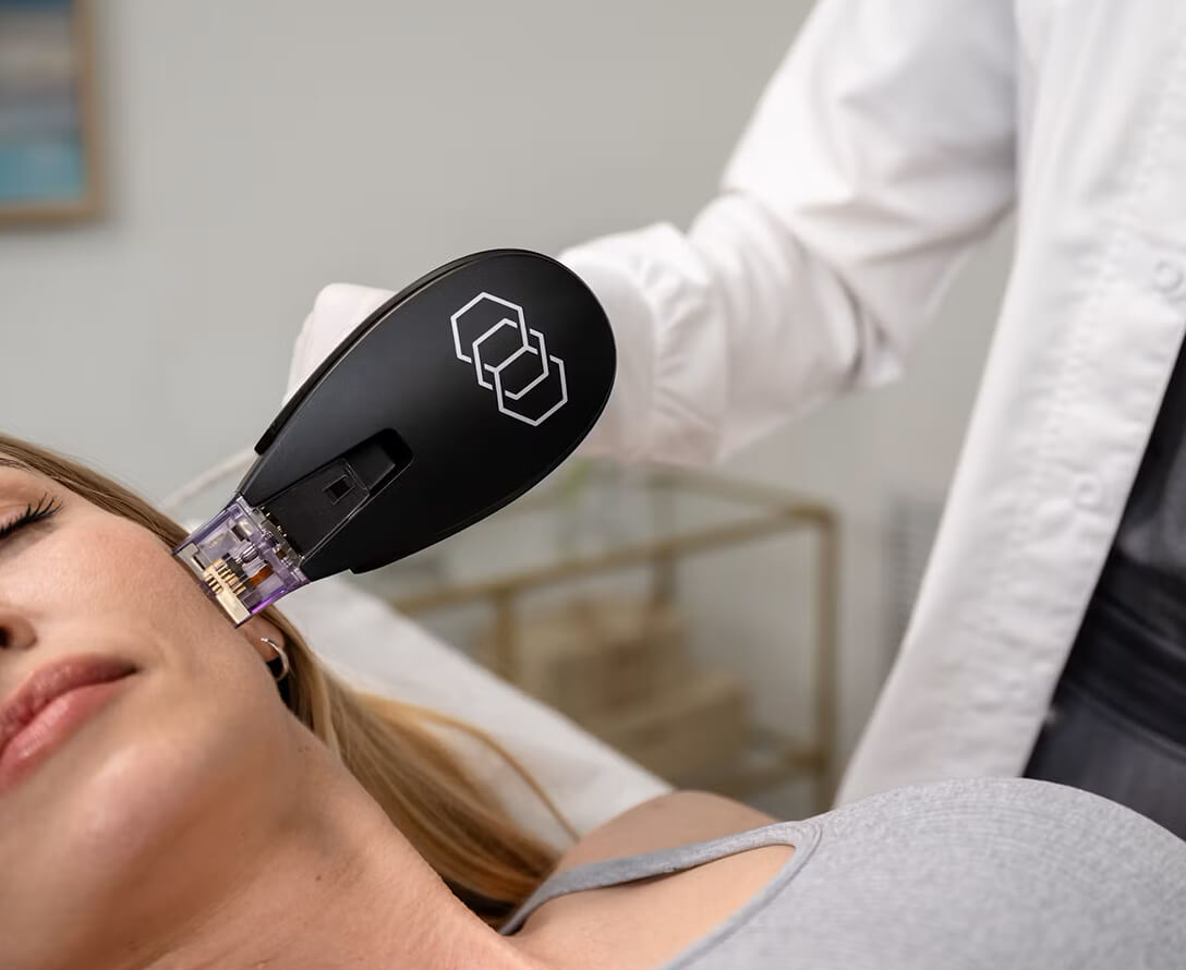 Morpheus8 vs. Microneedling: Which Skin Rejuvenation Technique is Right for You? | EverYoung Skin Clinic Vancouver