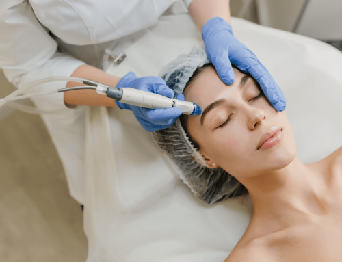 SecretRF Skin Tightening & Non-Surgical Facelift