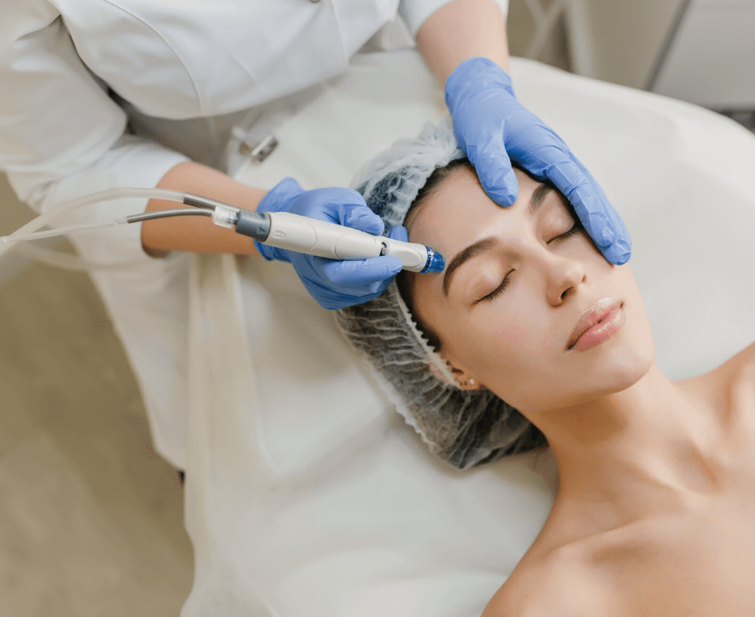 Overview of SecretRF | EverYoung Skin Care Clinic Vancouver