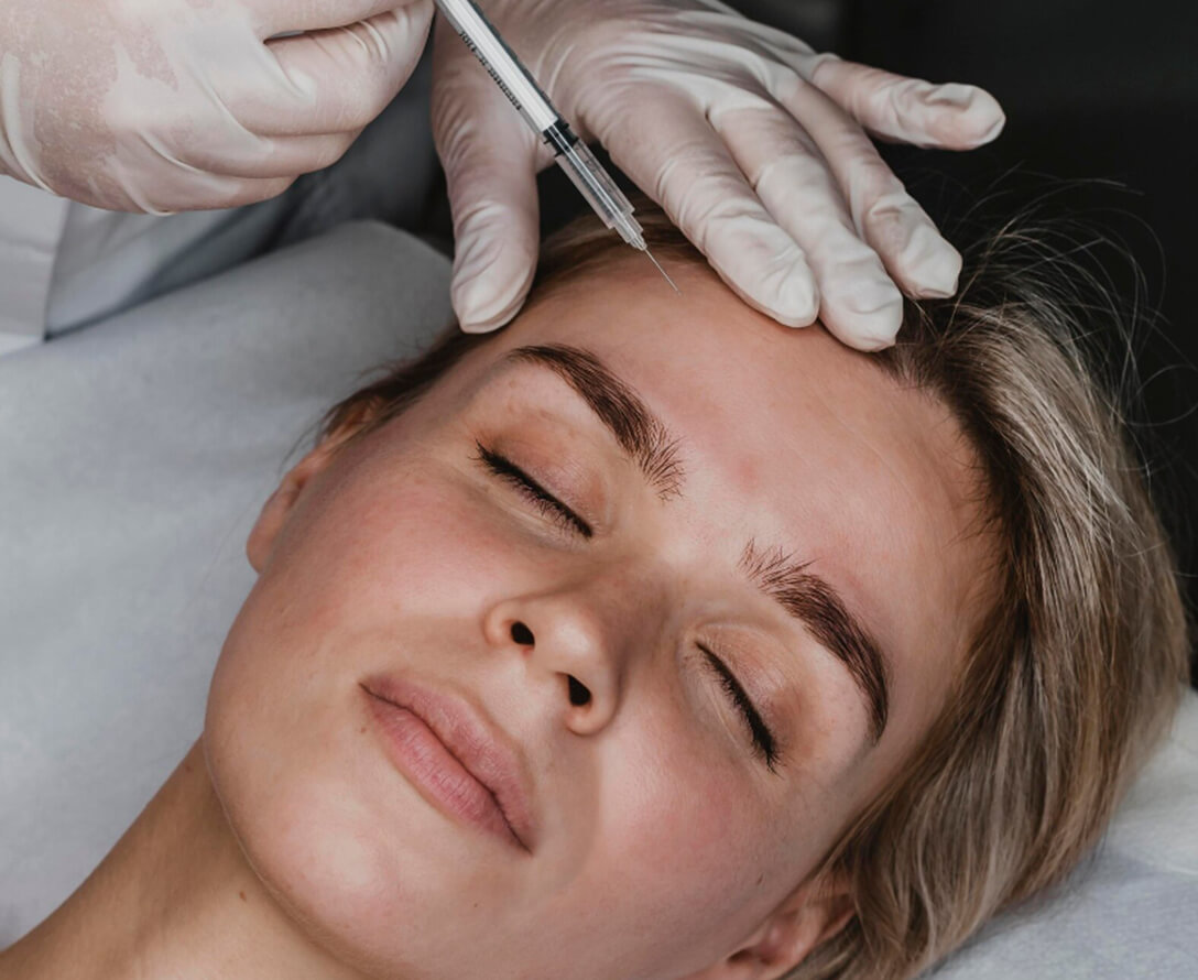 PRP Skin Therapy—Vampire Facial | EverYoung Skin Care Clinic Vancouver