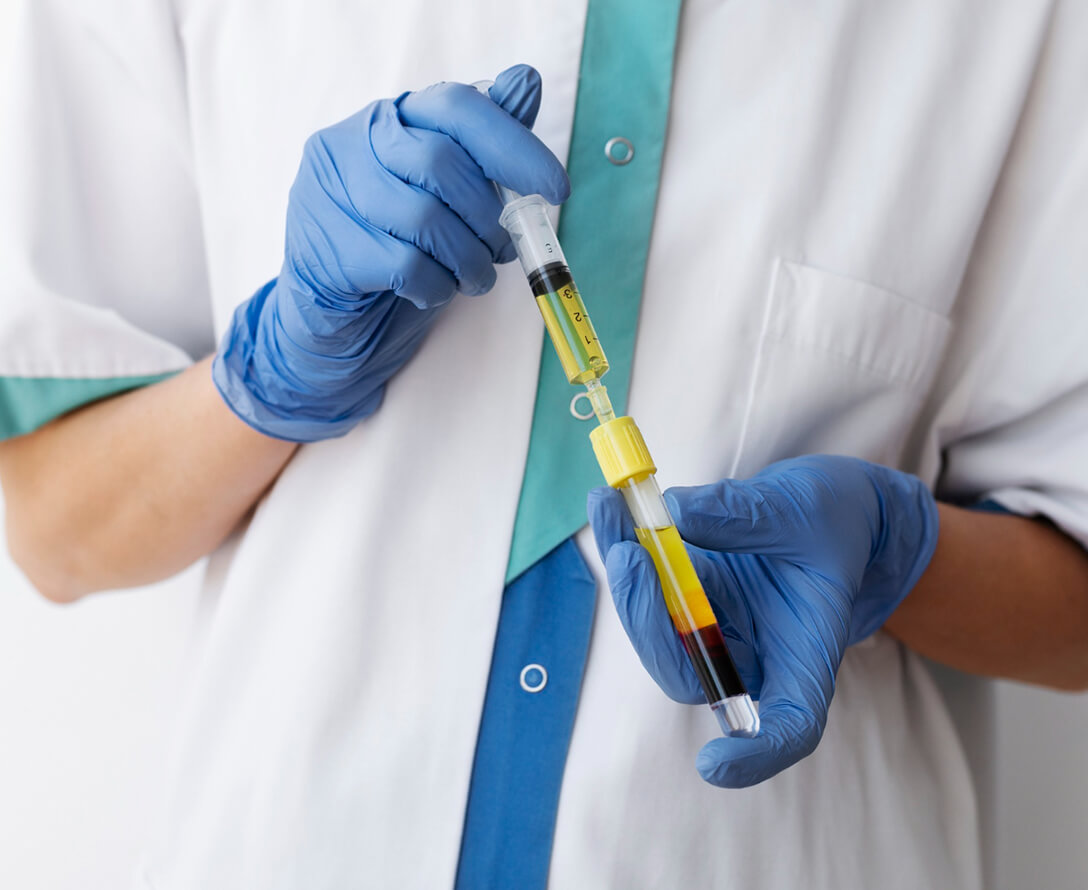 Regenerate Your Skin with PRP Platelet-Rich Plasma | EverYoung Skin Clinic