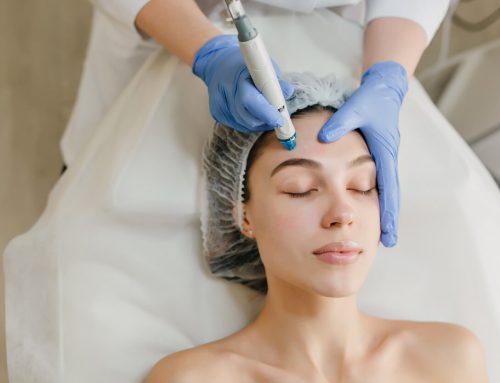 RF Microneedling vs. Microneedling: Which Treatment is Right for You?