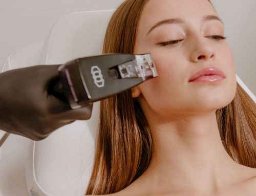 7 Essential Things to Know About Morpheus8™