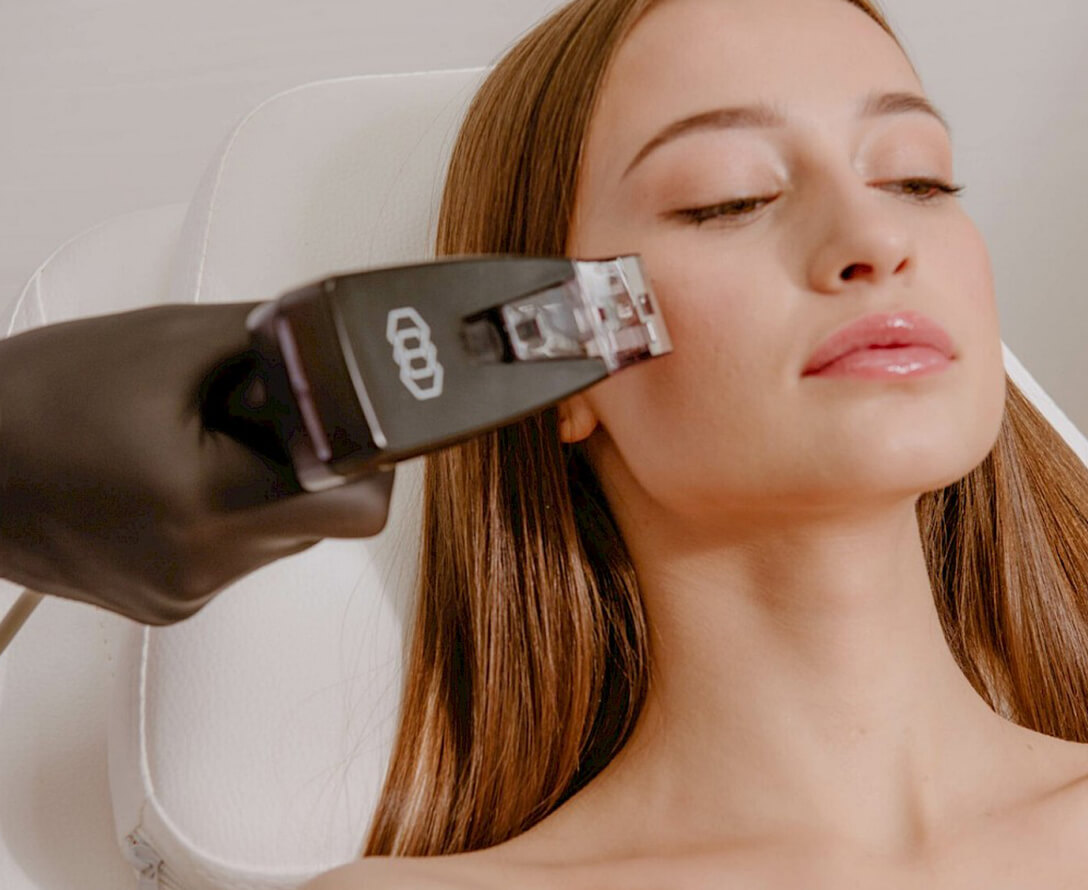 7 Essential Things to Know About Morpheus8™