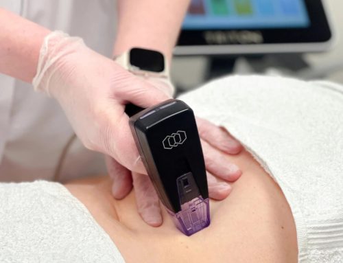 Sylfirm X vs. Morpheus8: Which Skin Treatment Should You Choose?