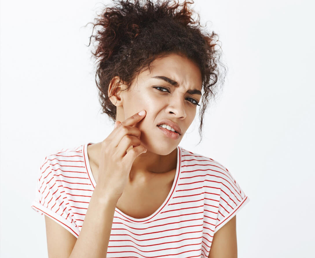 The Ultimate Guide to Acne Treatment | EverYoung Skin Care Clinic Vancouver