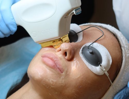 Differences Between BBL & IPL Treatments