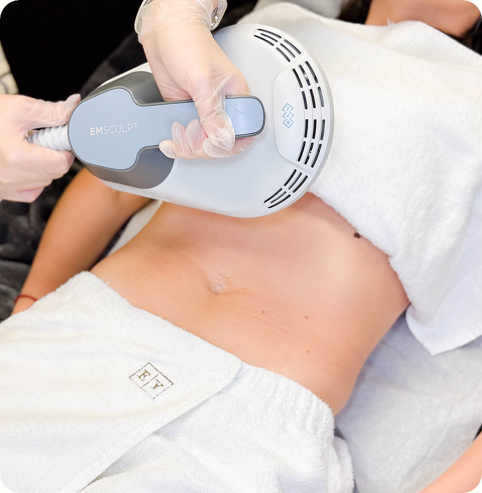 EMSculpting Treatment in Vancouver | EverYoung Skin Clinic