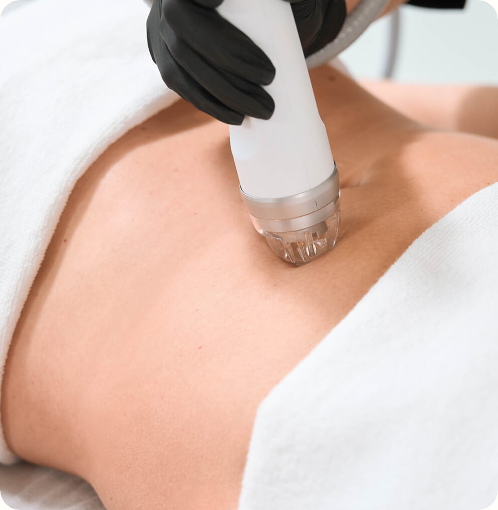 RF-Skin-Tightening-Treatment-Vancouver RF Skin Tightening in Vancouver | EverYoung Skin Clinic