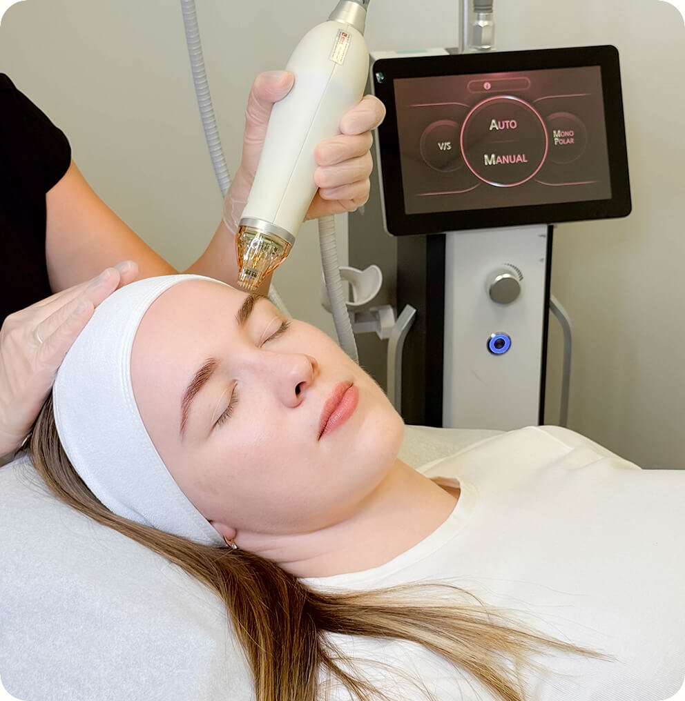 rf-skin-tightening-treatment RF Skin Tightening Vancouver | EverYoung Skin Clinic