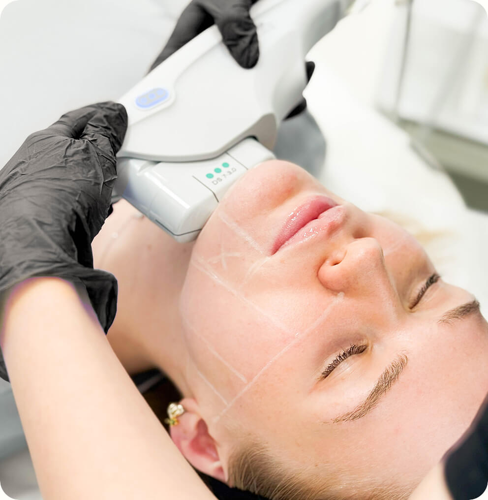 Ultherapy Vancouver | EverYoung Skin Clinic