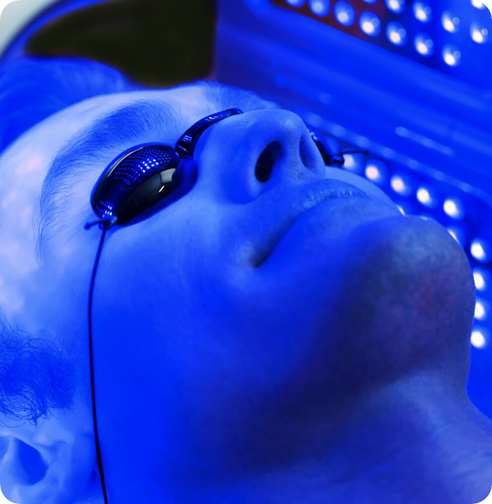 Blue Light Therapy PDT Vancouver | EverYoung Skin Clinic