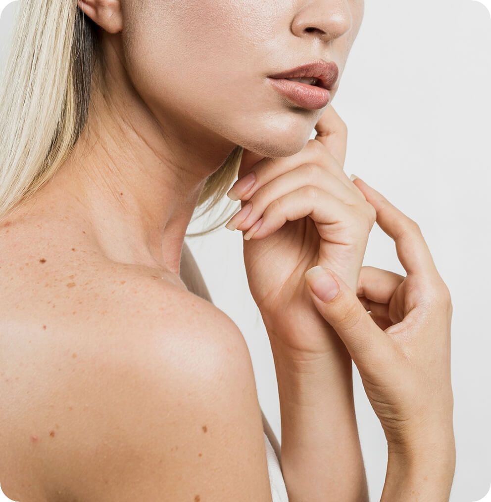 Laser Skin Tightening Vancouver | EverYoung Skin Clinic