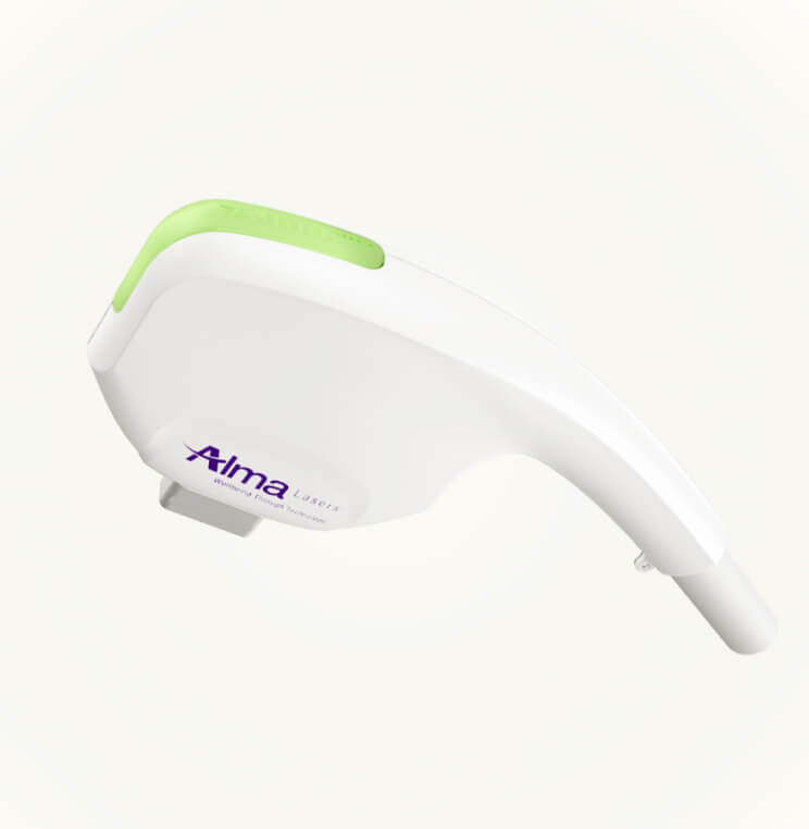 ALMA-LASER-HAIR-REMOVAL Alma Laser Hair Removal Vancouver | EverYoung Skin Clinic