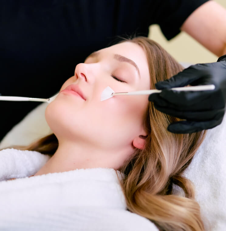 CHEMICAL-PEEL Chemical Peels Vancouver | Facial Peel Treatment at EverYoung Skin Clinic