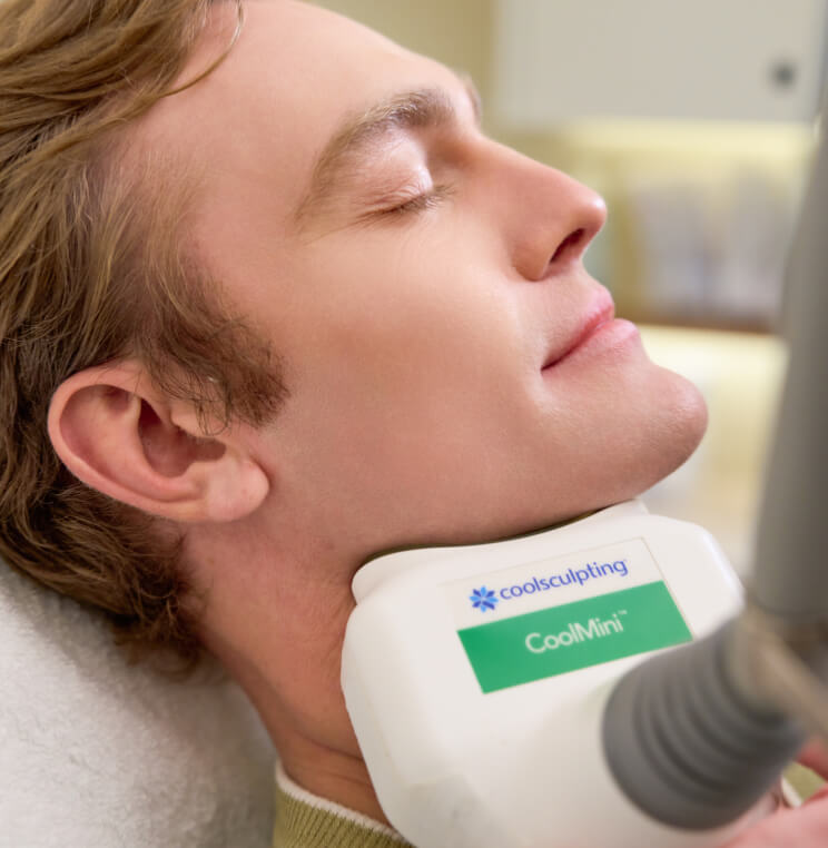 COOLSCULPTING-DOUBLE-CHIN CoolSculpting® Vancouver | EverYoung Skin Clinic