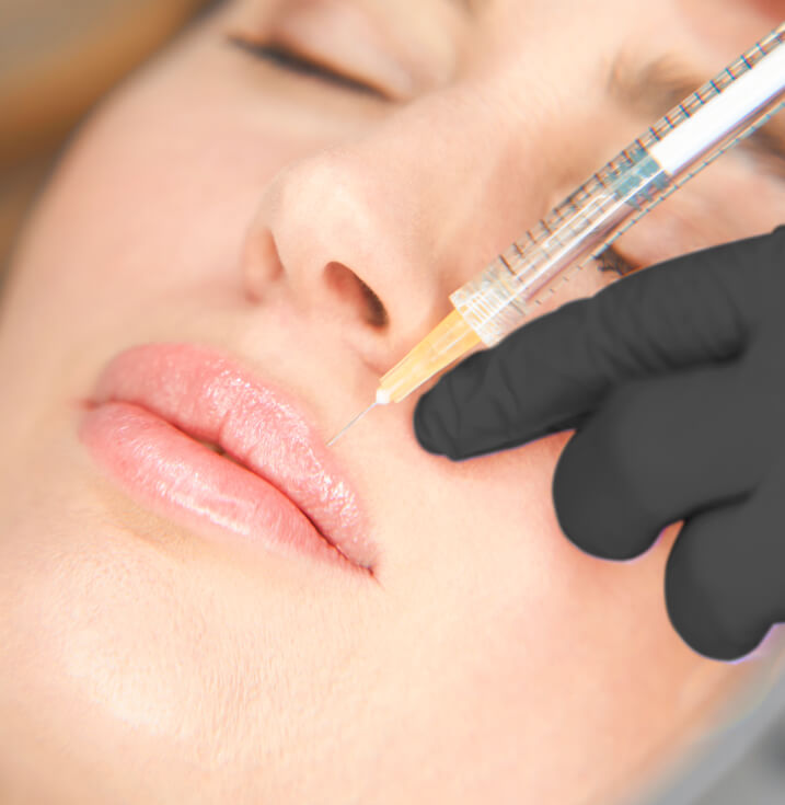 DERMAL-FILLER Vancouver Dermal Fillers Clinic | EverYoung Skin Clinic