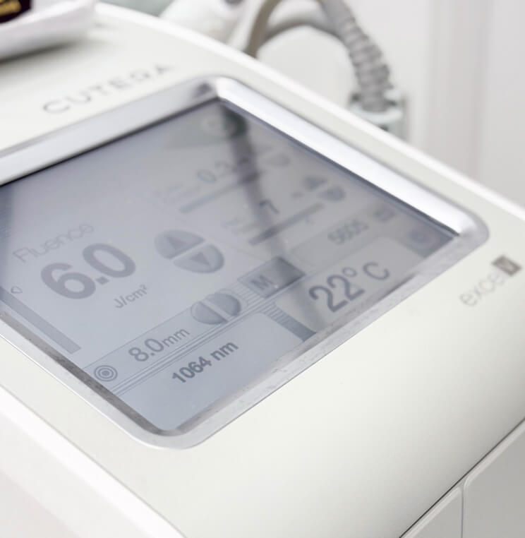 EXCEL-V Excel-V Treatment Vancouver | EverYoung Skin Clinic