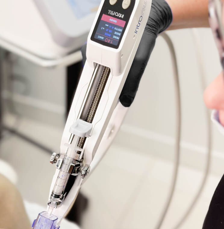 INTROFILL Introfill HA Boost Vancouver | EverYoung Skin Clinic