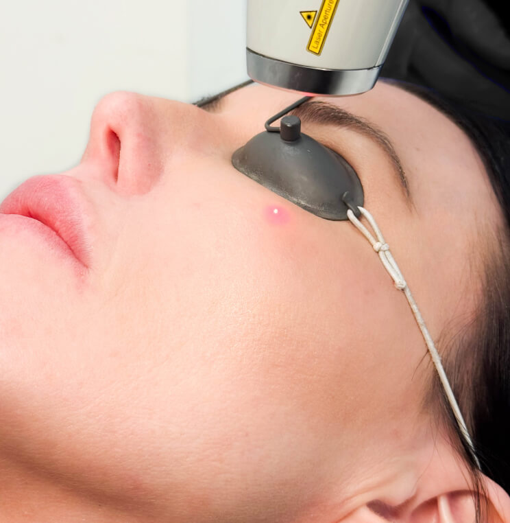 LASER-GENESIS Laser Genesis Vancouver | EverYoung Skin Clinic