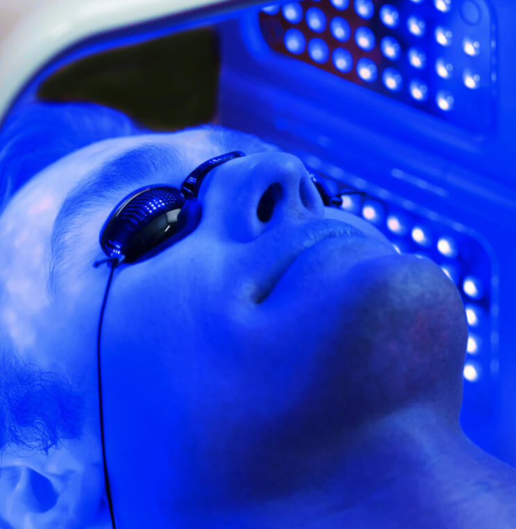 PDT BLU-U® Blue Light Therapy Vancouver | EverYoung Skin Clinic