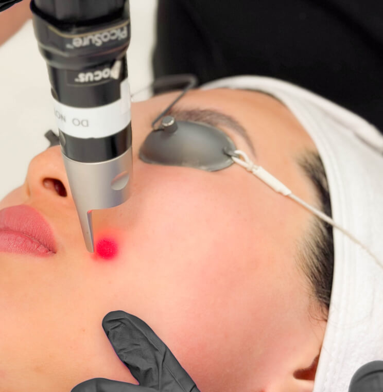 PICOSURE PicoSure Skin Revitalization Vancouver | EverYoung Skin Clinic