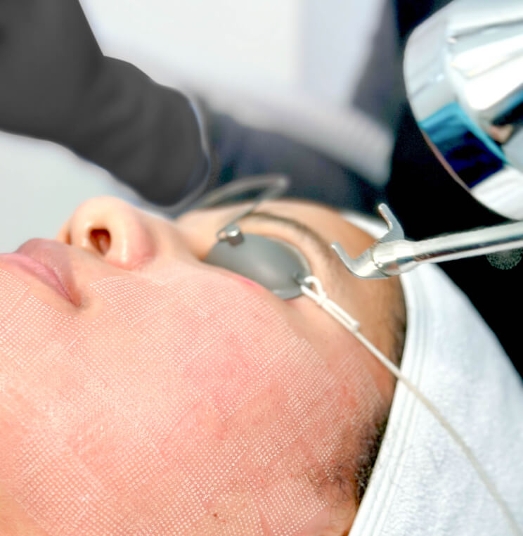 PROFRACTIONAL ProFractional™ Laser Resurfacing | EverYoung Skin Clinic Vancouver