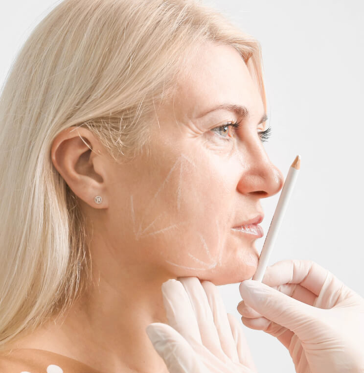 SCULPTRA Sculptra® Fillers Vancouver | EverYoung Skin Clinic