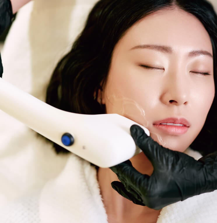 SOFWAVE Sofwave™ Vancouver | EverYoung Laser Skin Clinic